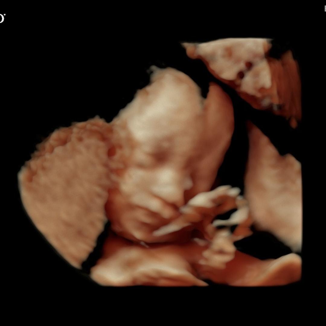 Photo shared by Amy for their Babylist baby registry.