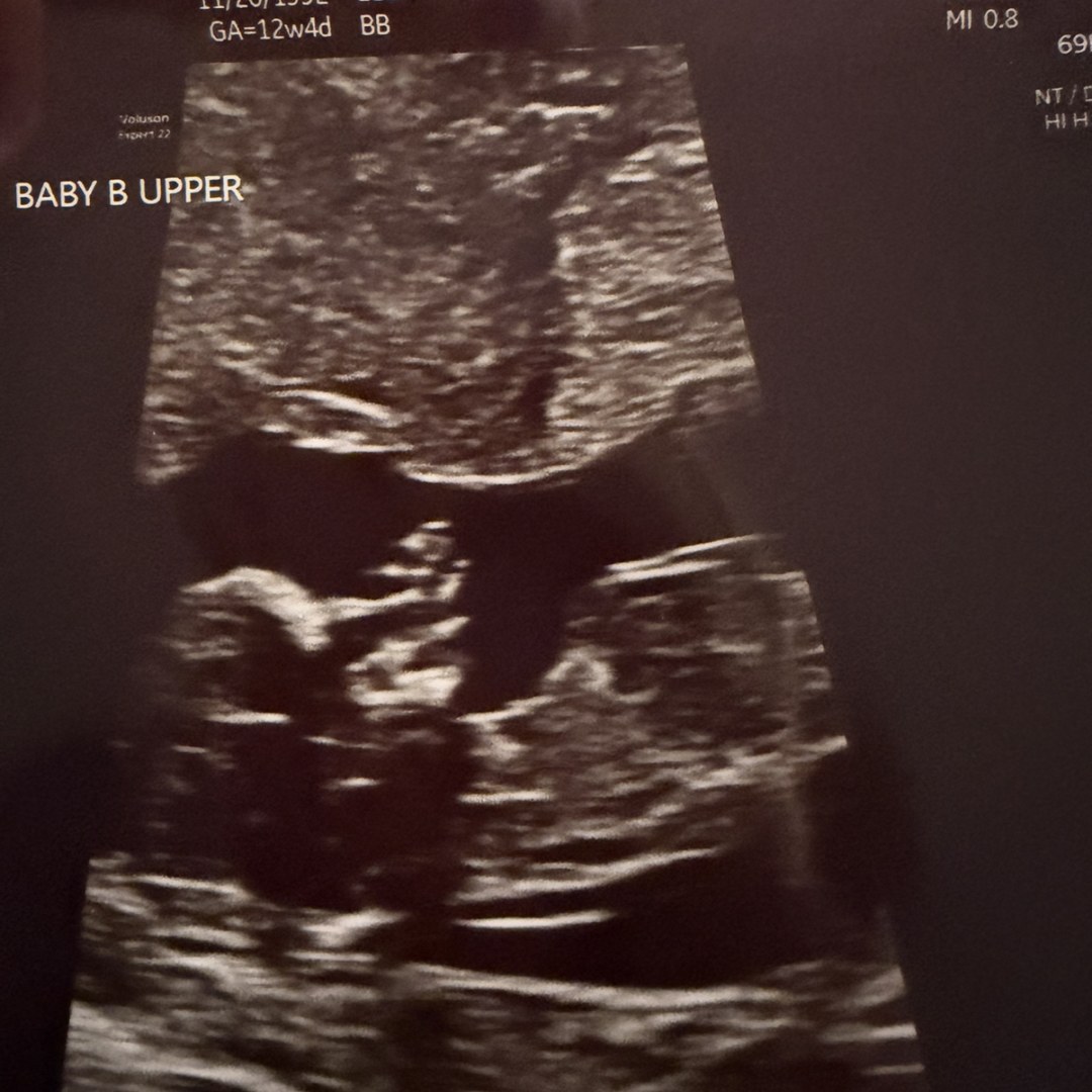 Photo shared by Jessica for their Babylist baby registry.