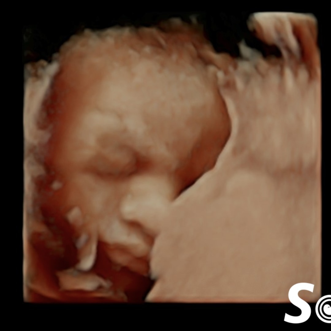 Photo shared by Caitlin for their Babylist baby registry.