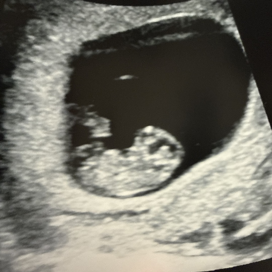 Photo shared by Victoria for their Babylist baby registry.