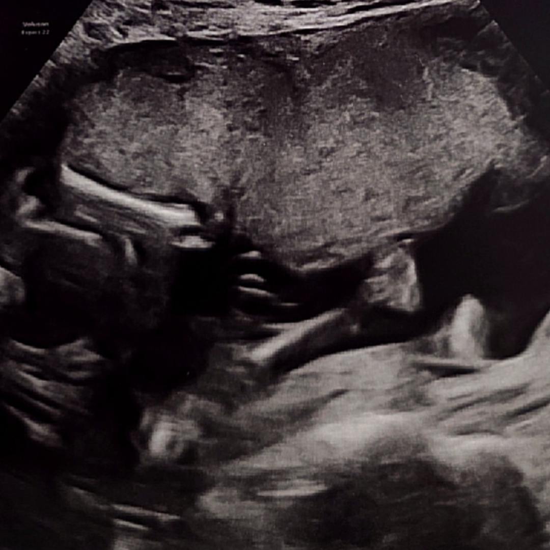 Photo shared by Rebecca for their Babylist baby registry.