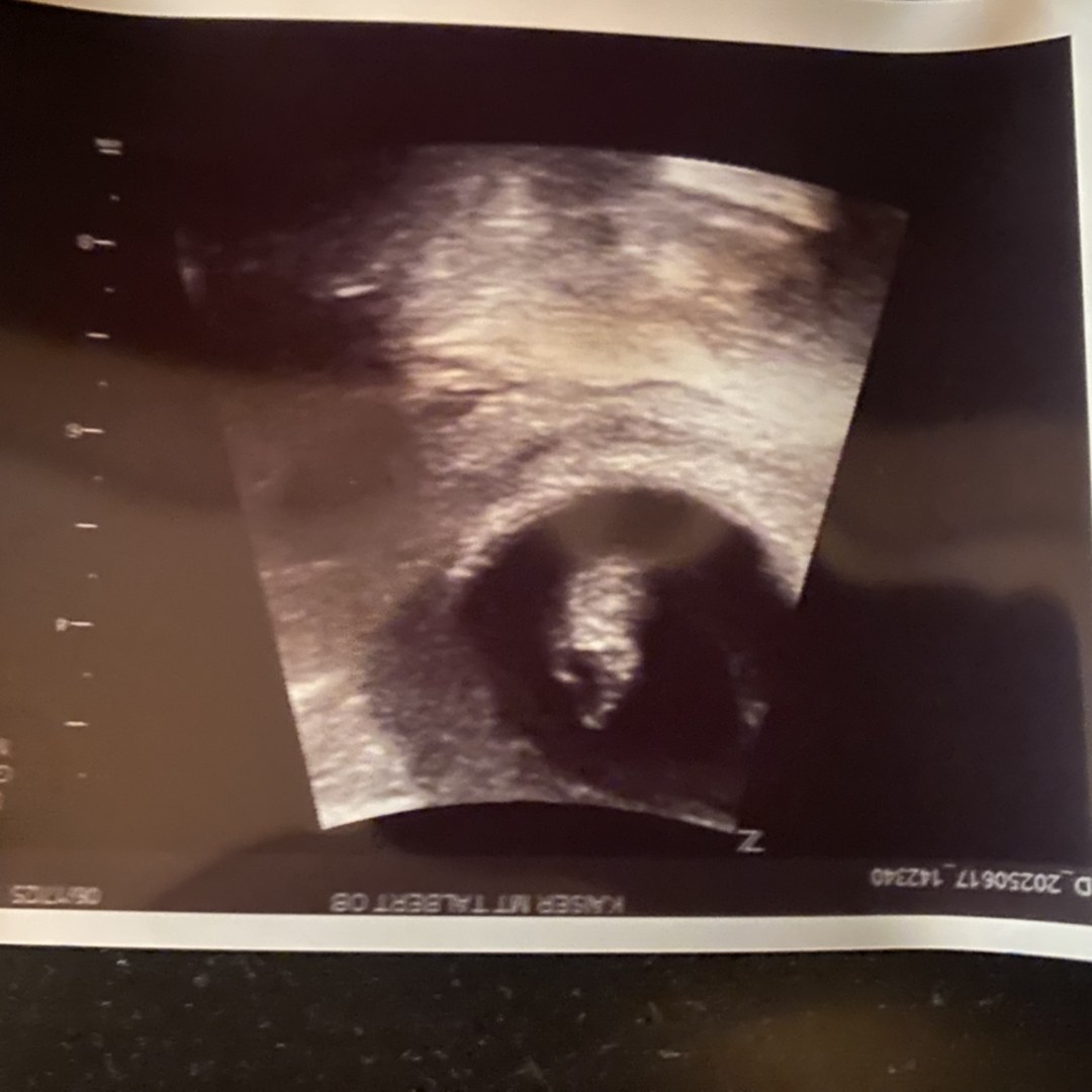 Photo shared by Nicole for their Babylist baby registry.