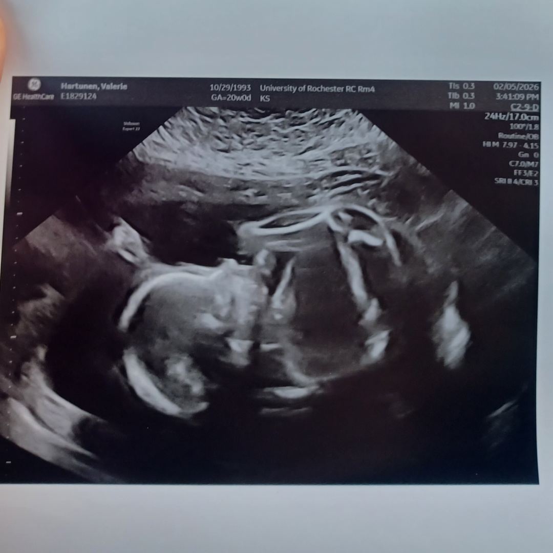 Photo shared by Valerie for their Babylist baby registry.