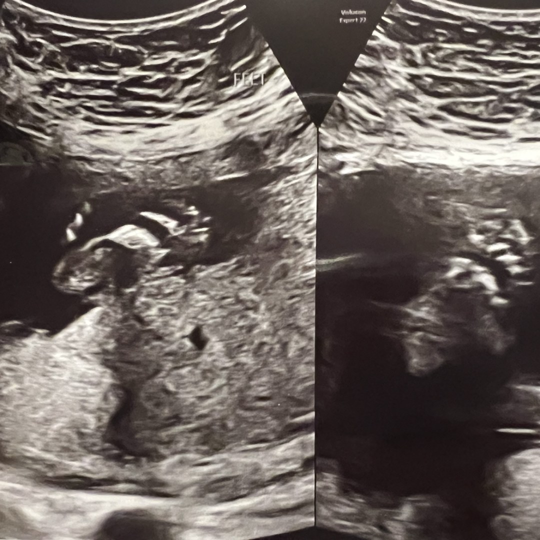 Photo shared by Katherine for their Babylist baby registry.