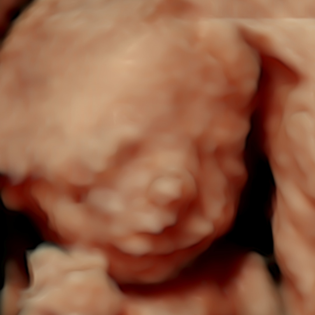 Photo shared by Megan for their Babylist baby registry.