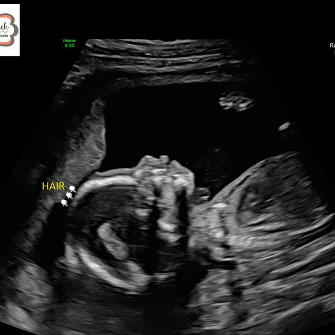 Photo shared by Shalyn for their Babylist baby registry.