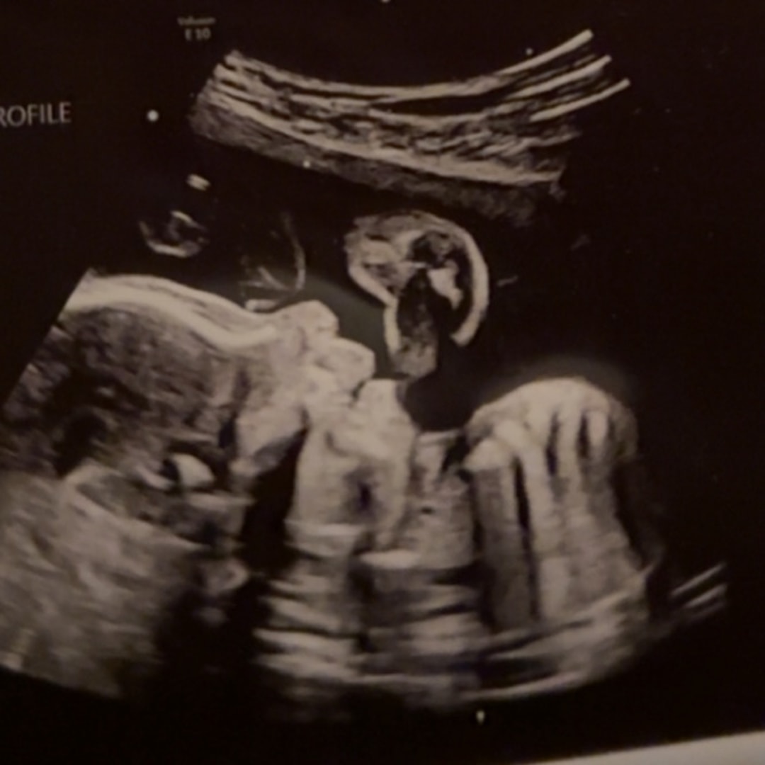 Photo shared by Jocelyn for their Babylist baby registry.