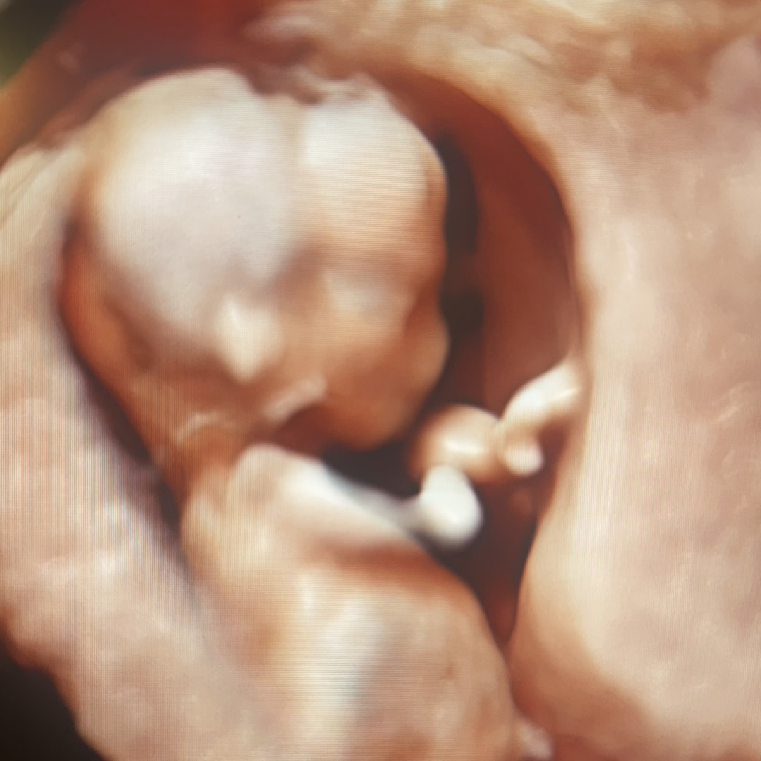 Photo shared by Michelle for their Babylist baby registry.