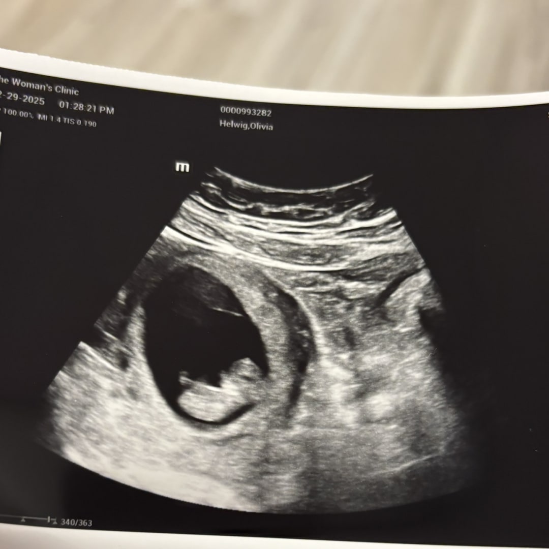 Photo shared by Olivia for their Babylist baby registry.