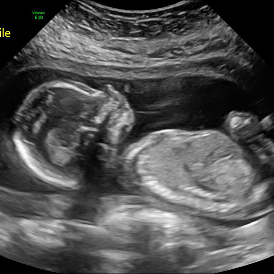 Photo shared by Annabelle for their Babylist baby registry.