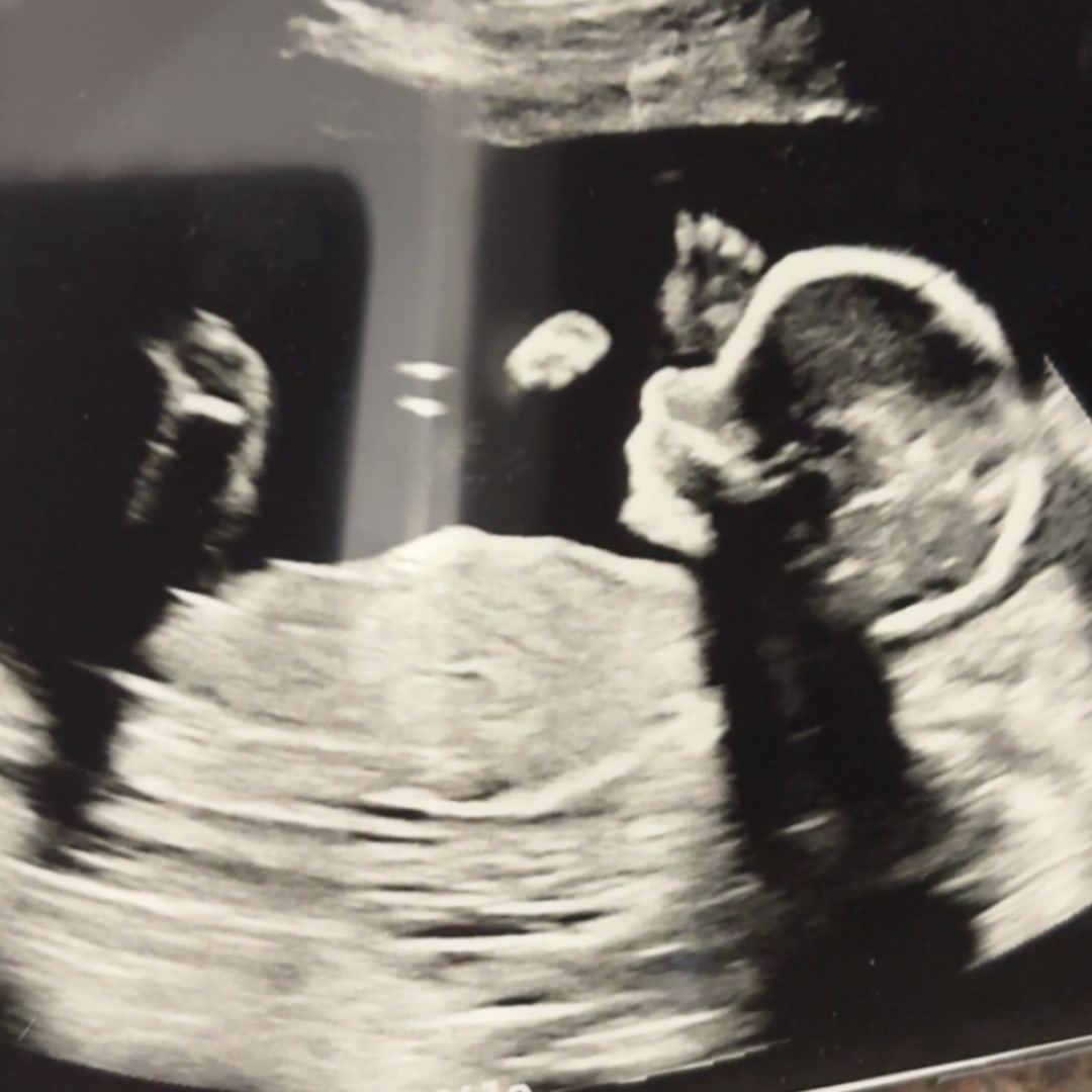 Photo shared by Jinnelle for their Babylist baby registry.