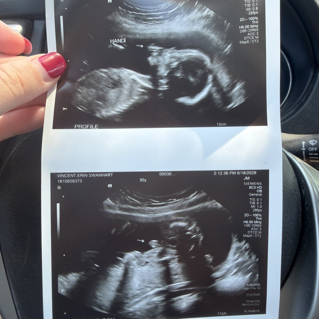 Photo shared by Erin for their Babylist baby registry.