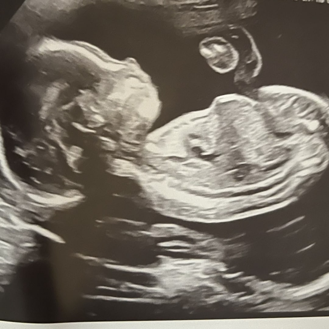 Photo shared by Danielle for their Babylist baby registry.