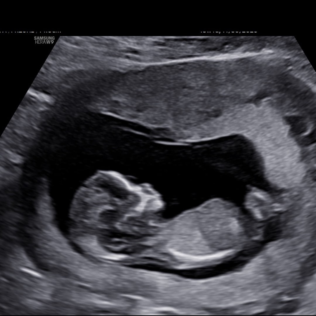 Photo shared by Hailey for their Babylist baby registry.