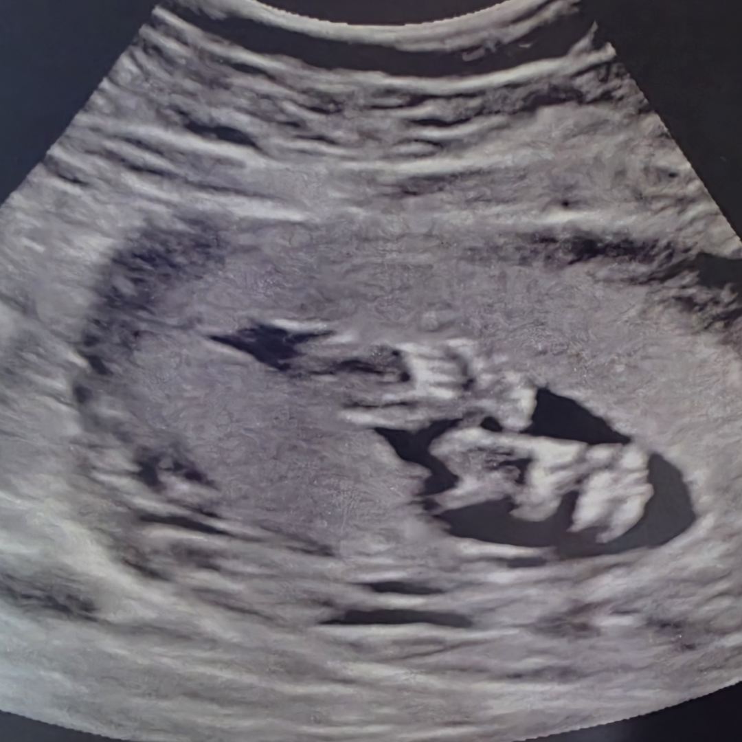Photo shared by Morgan for their Babylist baby registry.