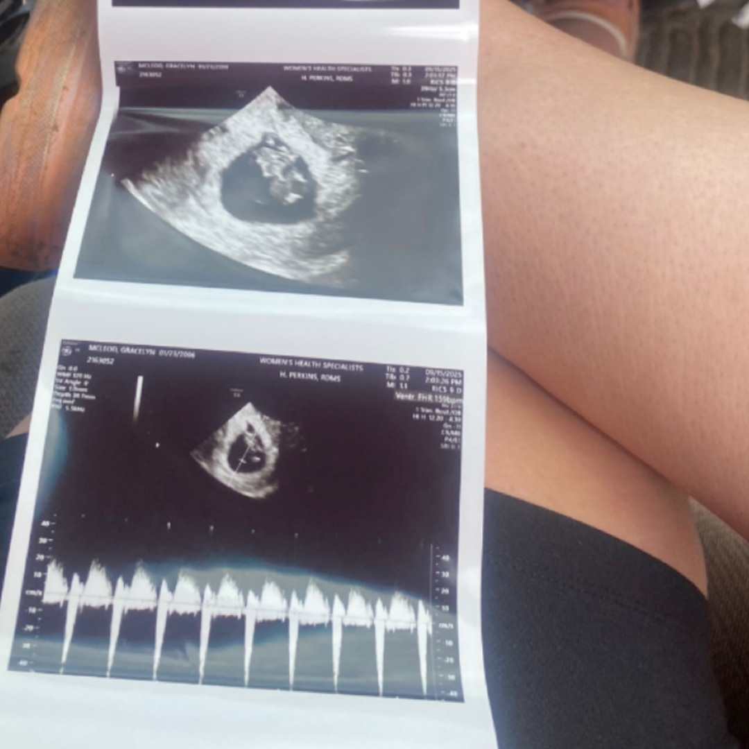 Photo shared by Gracelyn for their Babylist baby registry.