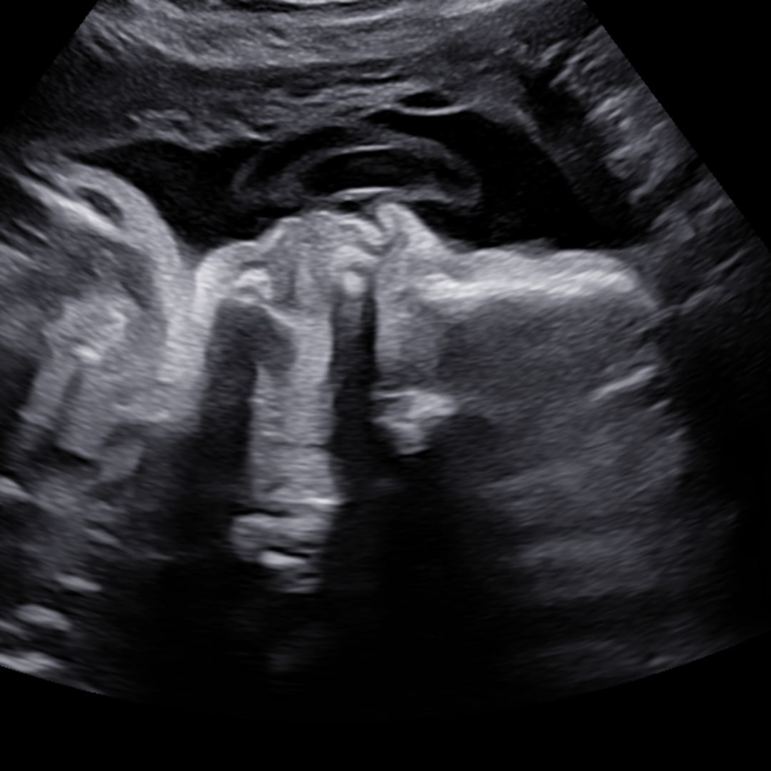 Photo shared by Kaylie for their Babylist baby registry.