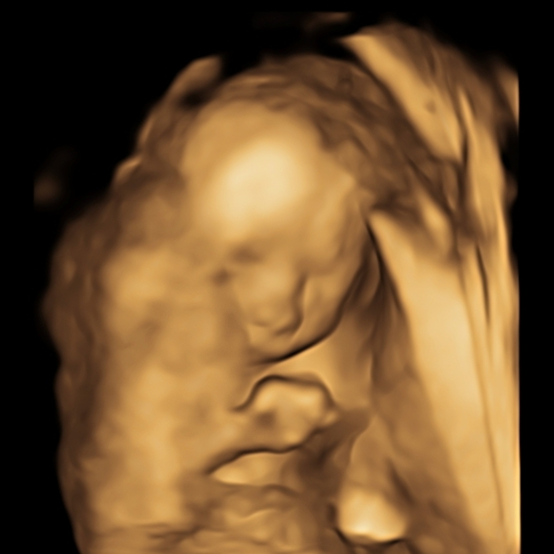 Photo shared by Olivia for their Babylist baby registry.