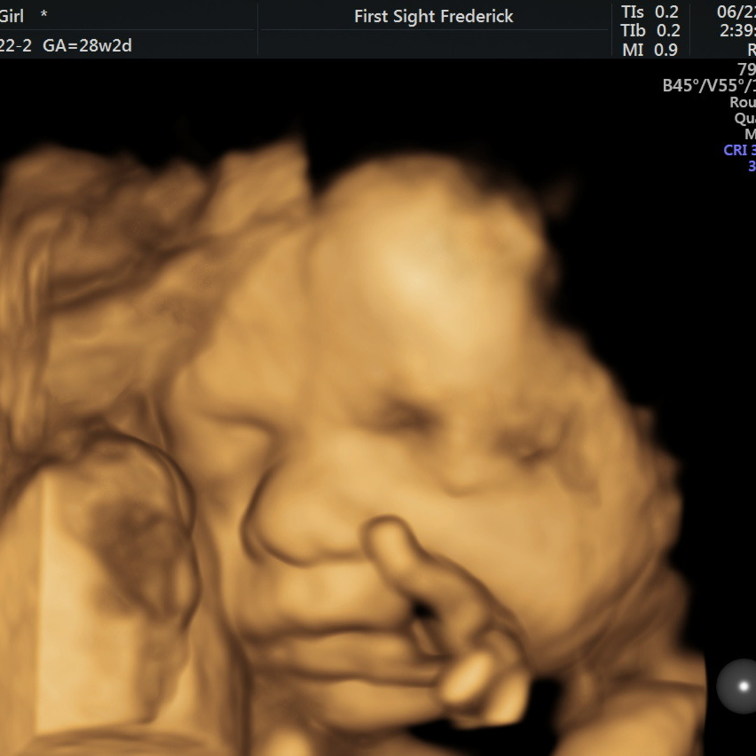 Photo shared by Regan for their Babylist baby registry.