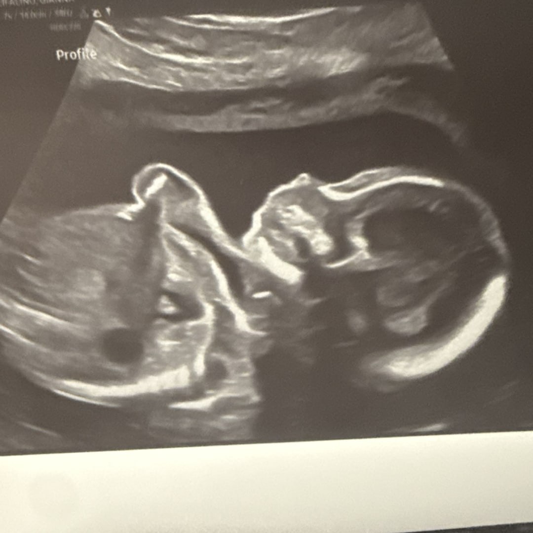 Photo shared by Gianna for their Babylist baby registry.