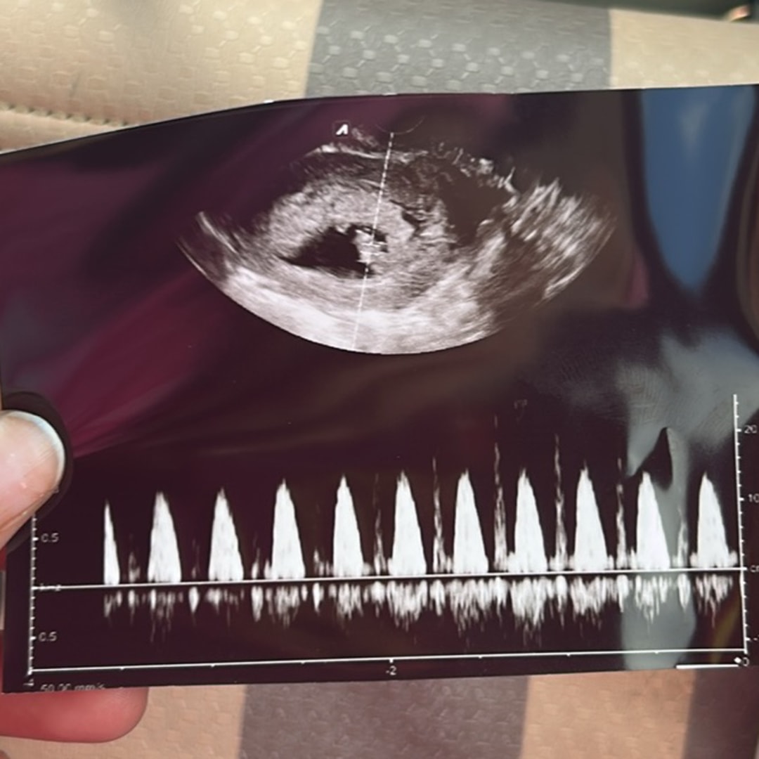 Photo shared by Janise for their Babylist baby registry.