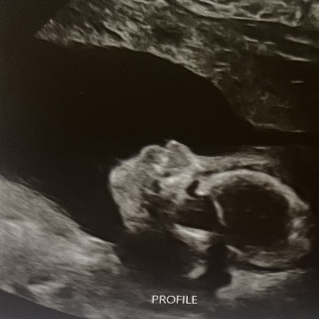 Photo shared by Annissa for their Babylist baby registry.