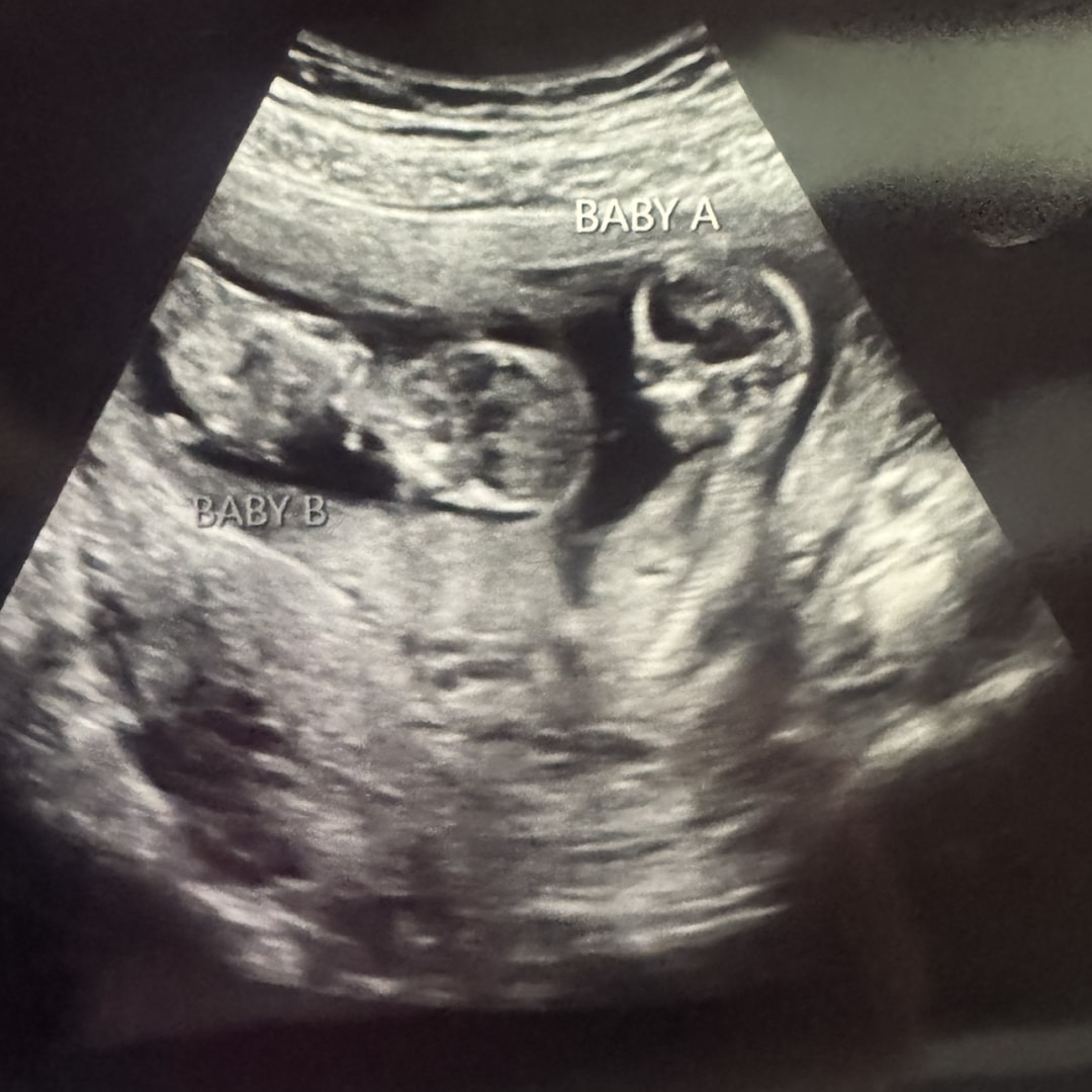 Photo shared by Heather for their Babylist baby registry.