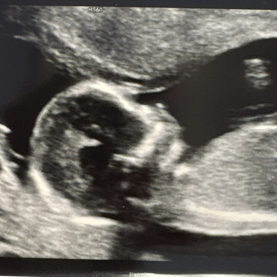 Photo shared by Stephanie for their Babylist baby registry.