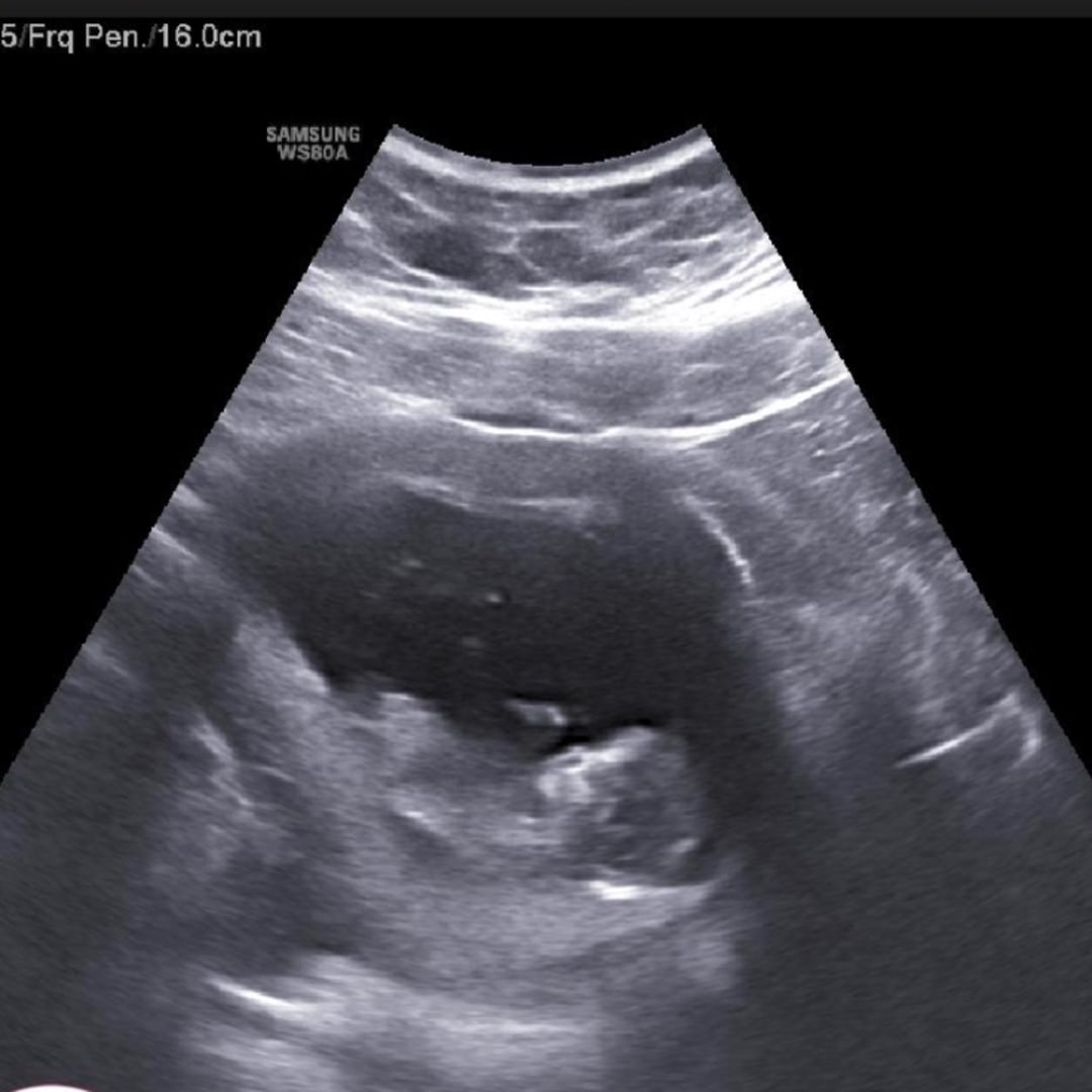 Photo shared by Aliyah for their Babylist baby registry.