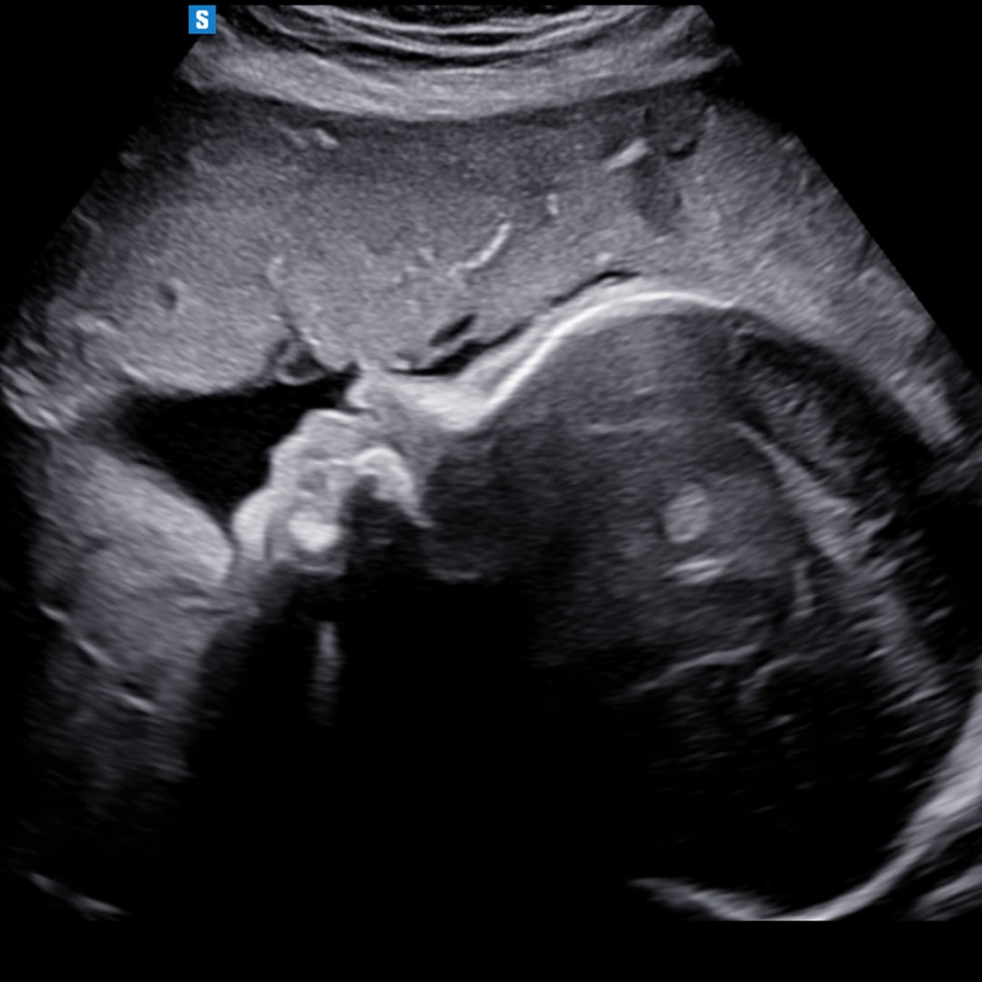 Photo shared by Alexandra for their Babylist baby registry.