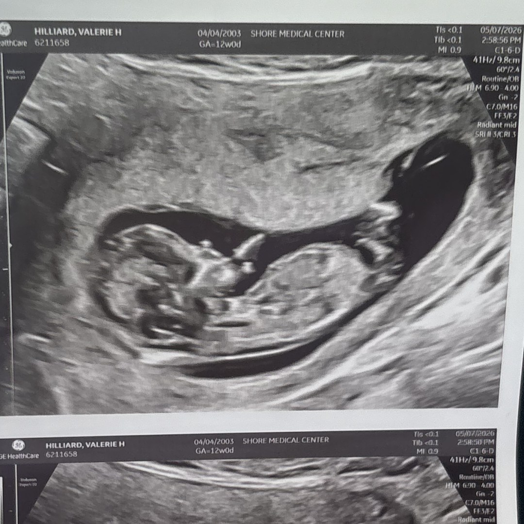 Photo shared by Valerie for their Babylist baby registry.