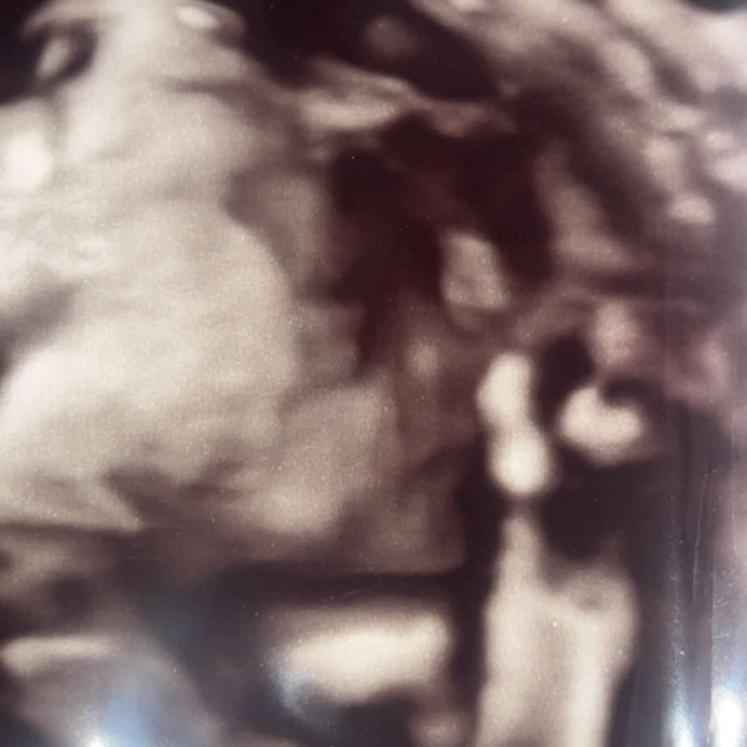 Photo shared by Kaley for their Babylist baby registry.
