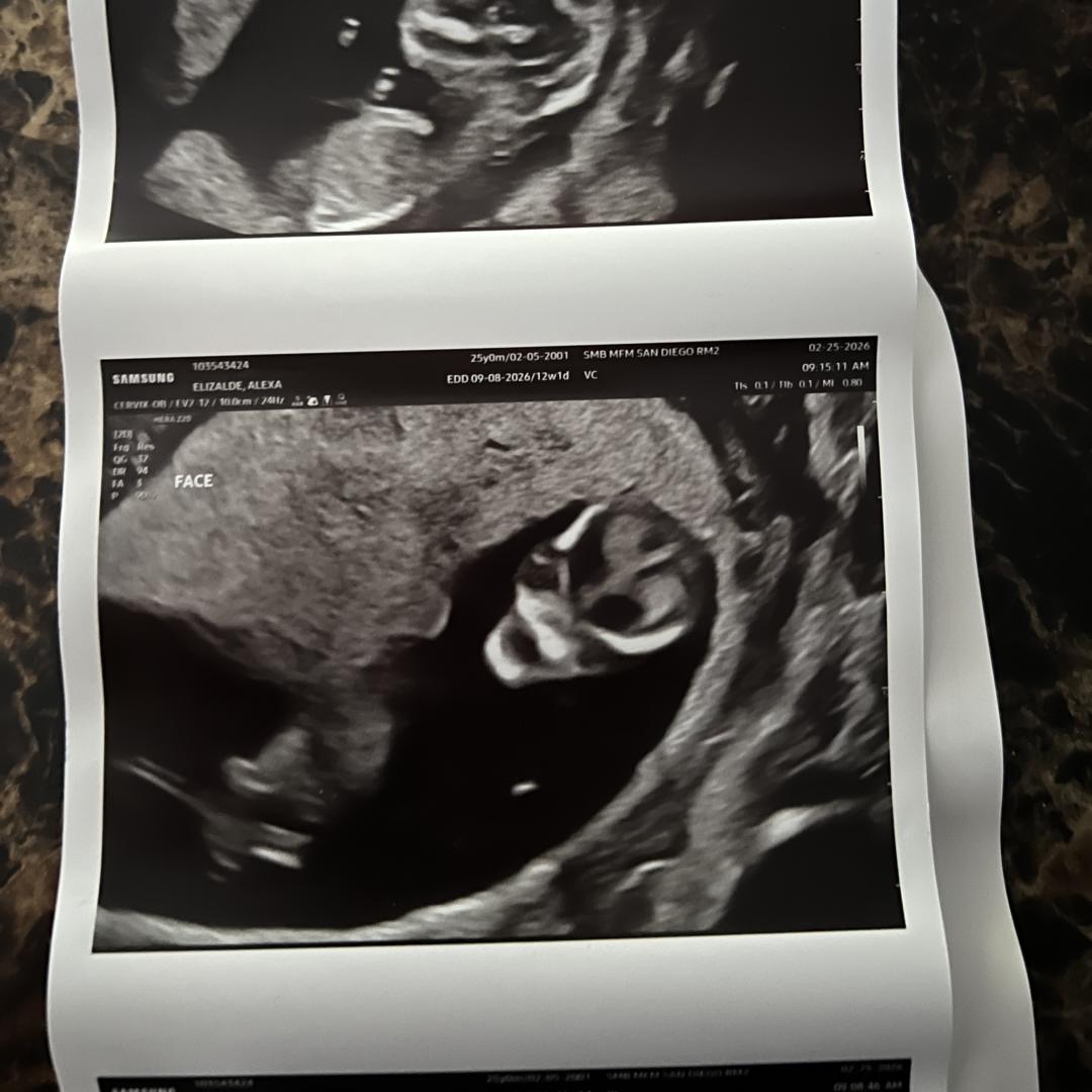 Photo shared by Alexa for their Babylist baby registry.