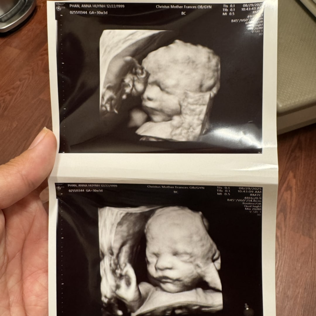 Photo shared by Anna for their Babylist baby registry.