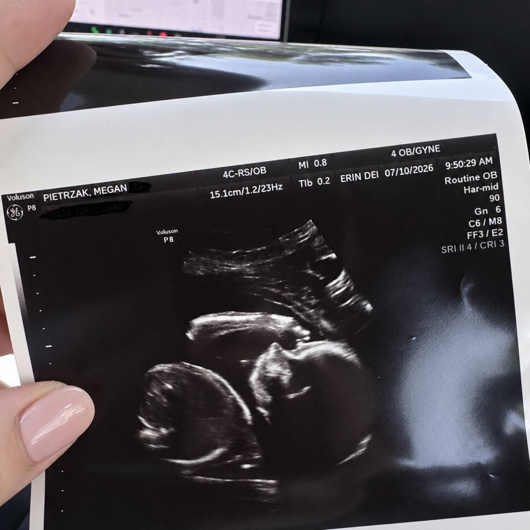 Photo shared by Megan for their Babylist baby registry.