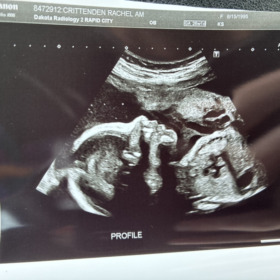 Photo shared by Rachel for their Babylist baby registry.