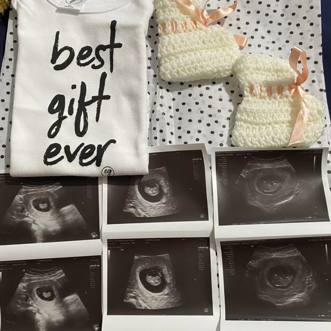 Photo shared by Norma for their Babylist baby registry.