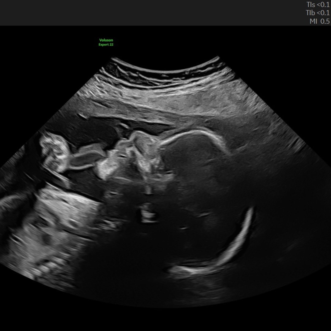 Photo shared by Erica for their Babylist baby registry.