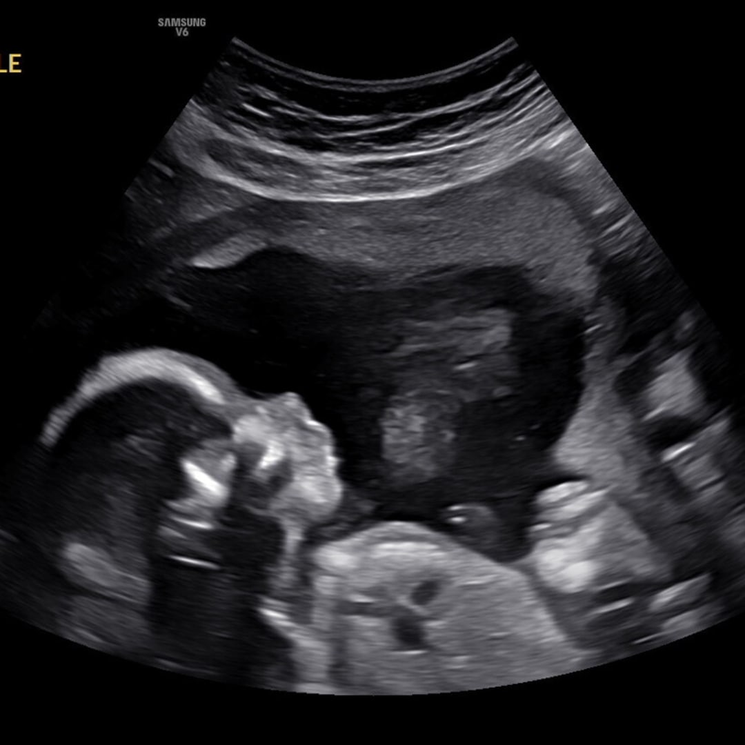 Photo shared by Kamryn for their Babylist baby registry.