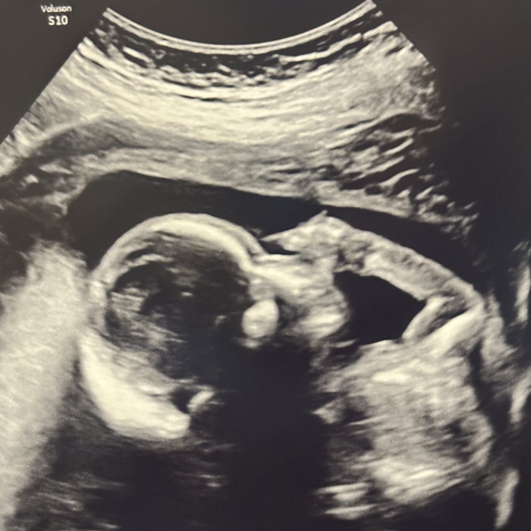 Photo shared by Collins for their Babylist baby registry.