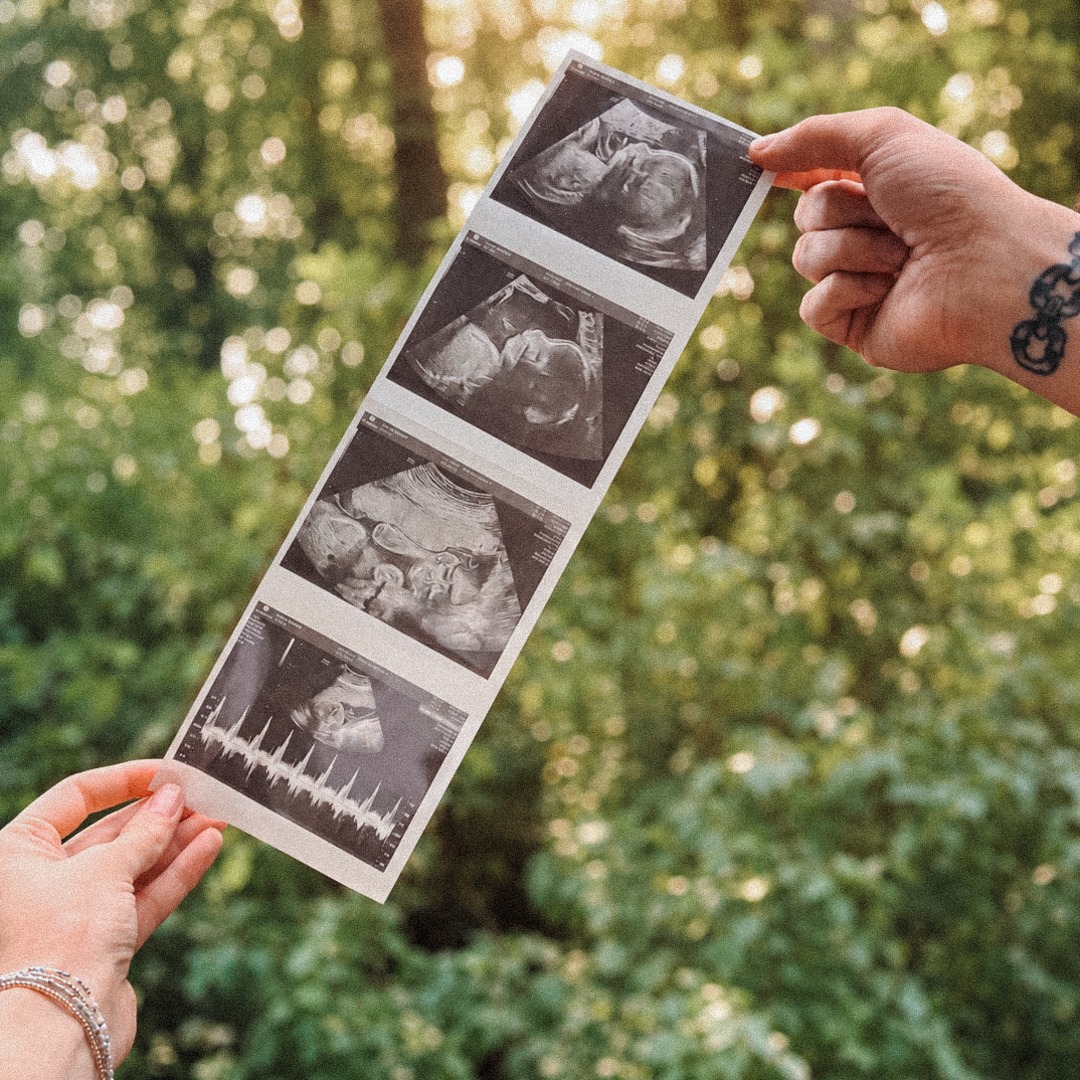 Photo shared by Shelbey for their Babylist baby registry.
