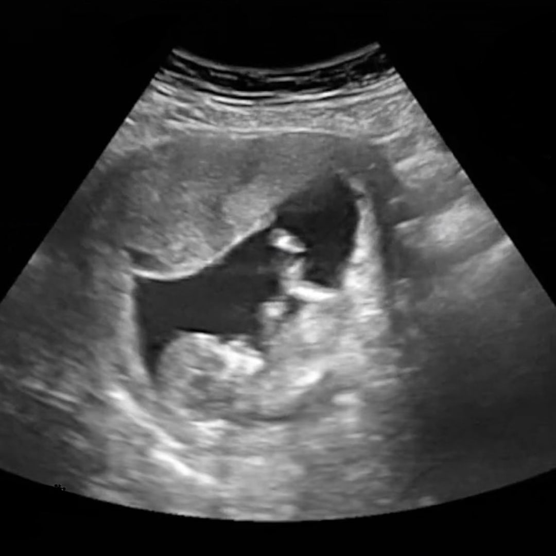 Photo shared by Helen for their Babylist baby registry.