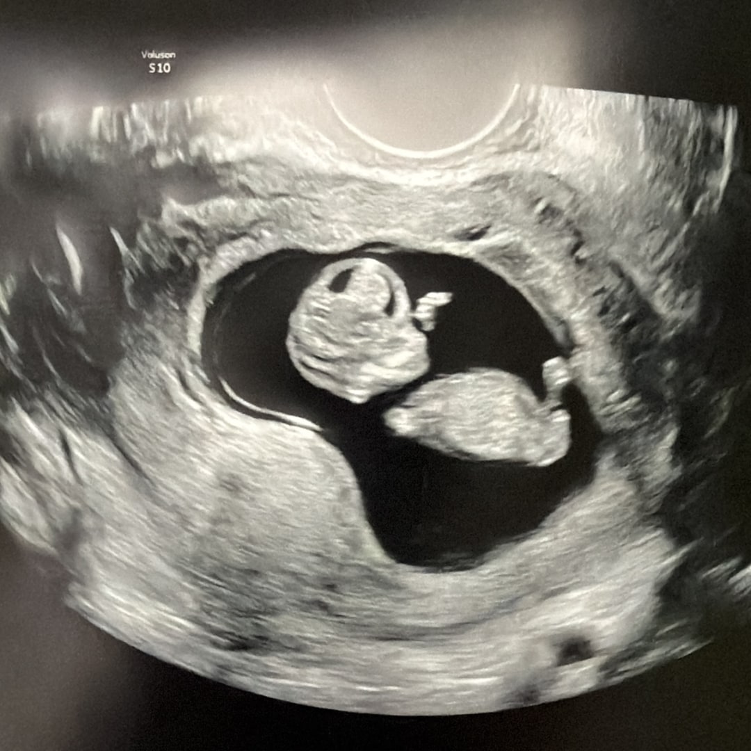 Photo shared by Margie for their Babylist baby registry.