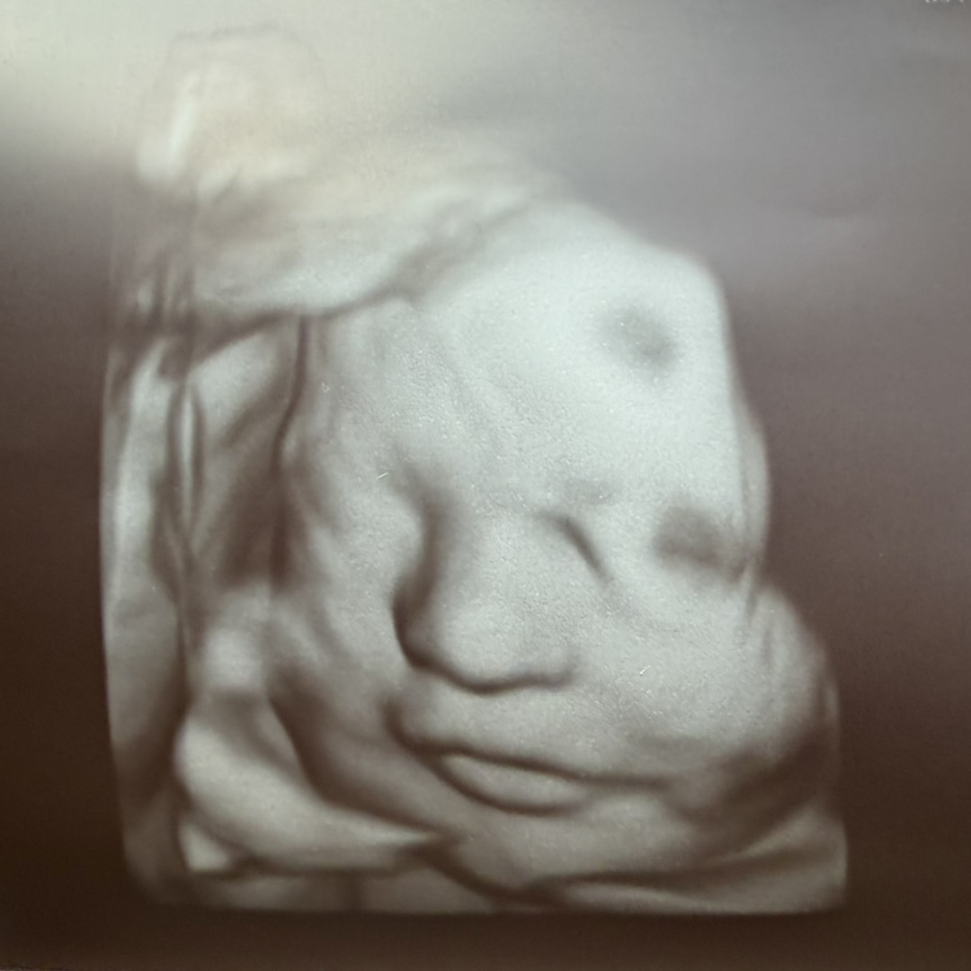 Photo shared by Stephanie for their Babylist baby registry.