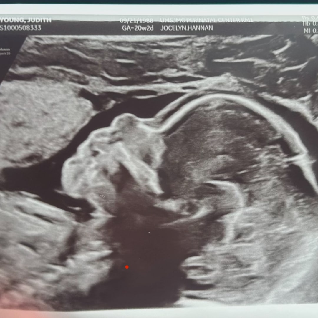 Photo shared by Judith for their Babylist baby registry.