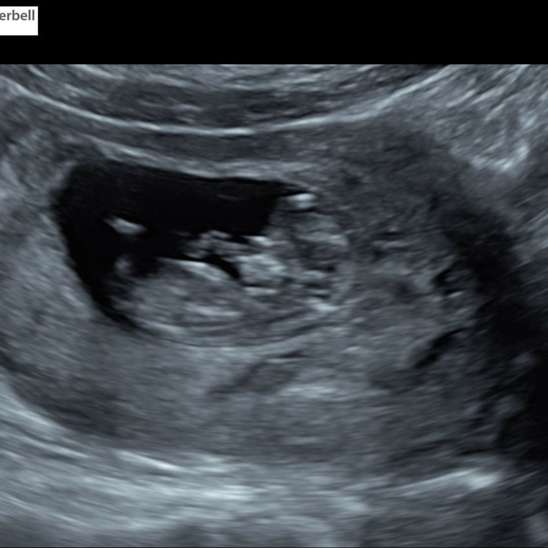 Photo shared by Jamil for their Babylist baby registry.