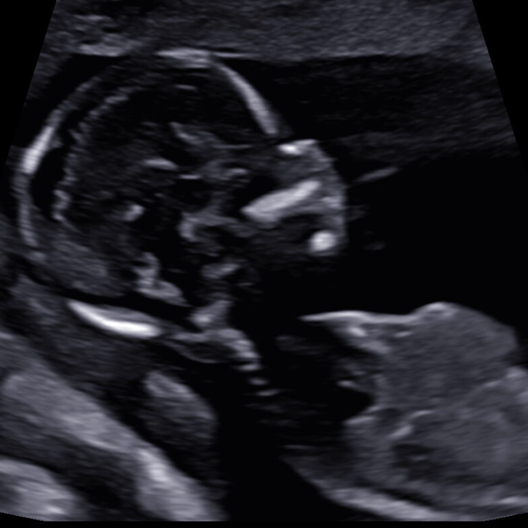 Photo shared by Brianna for their Babylist baby registry.