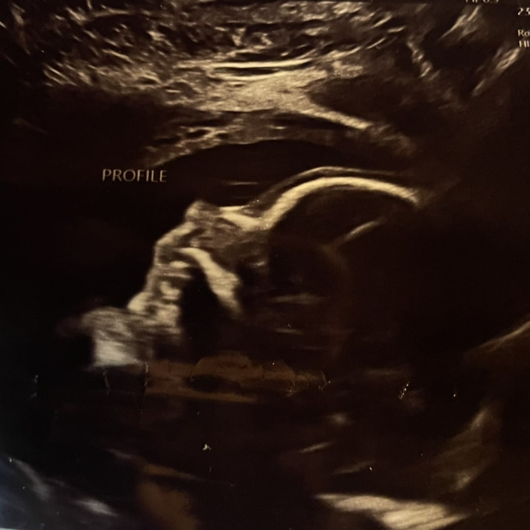 Photo shared by Cora for their Babylist baby registry.