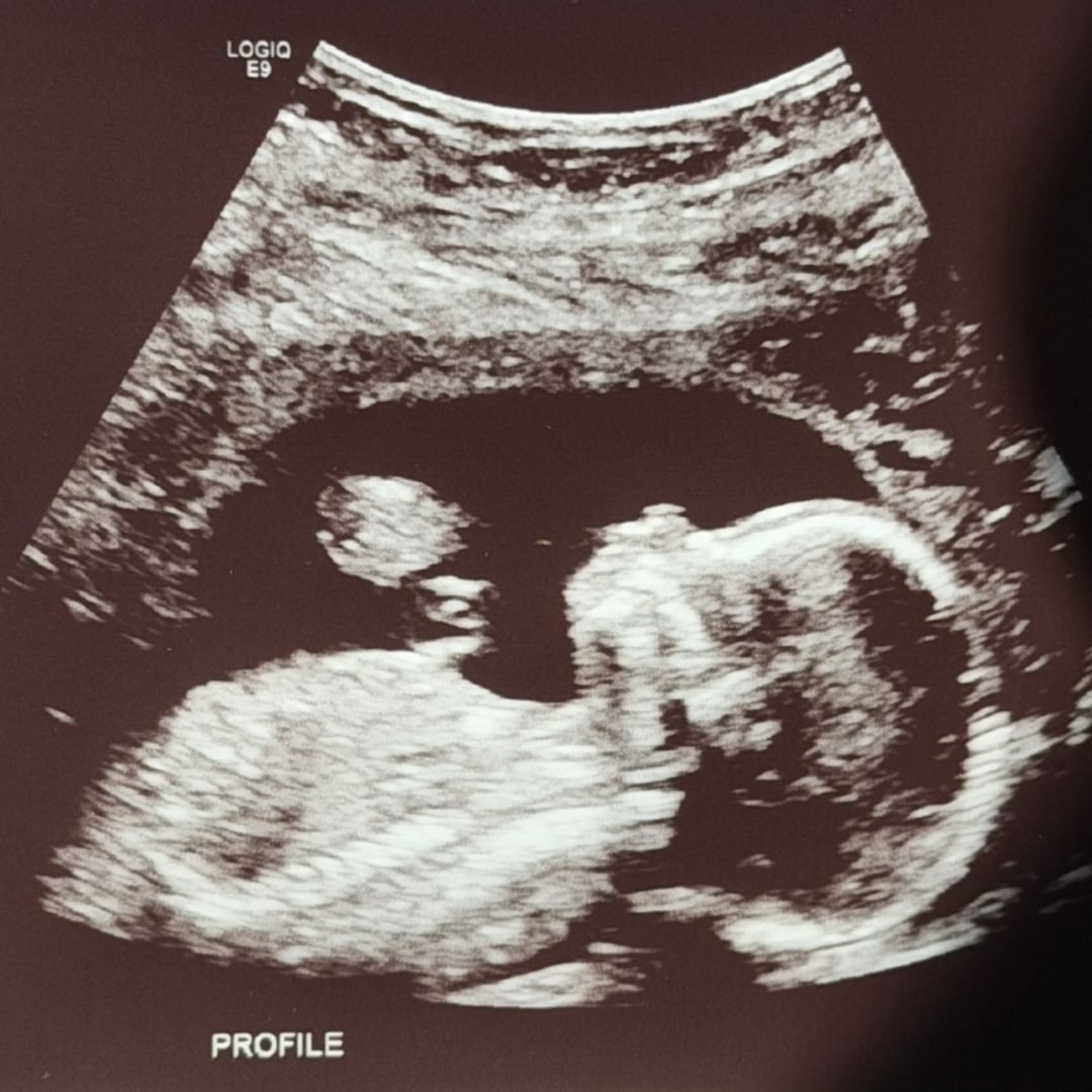 Photo shared by Anna for their Babylist baby registry.