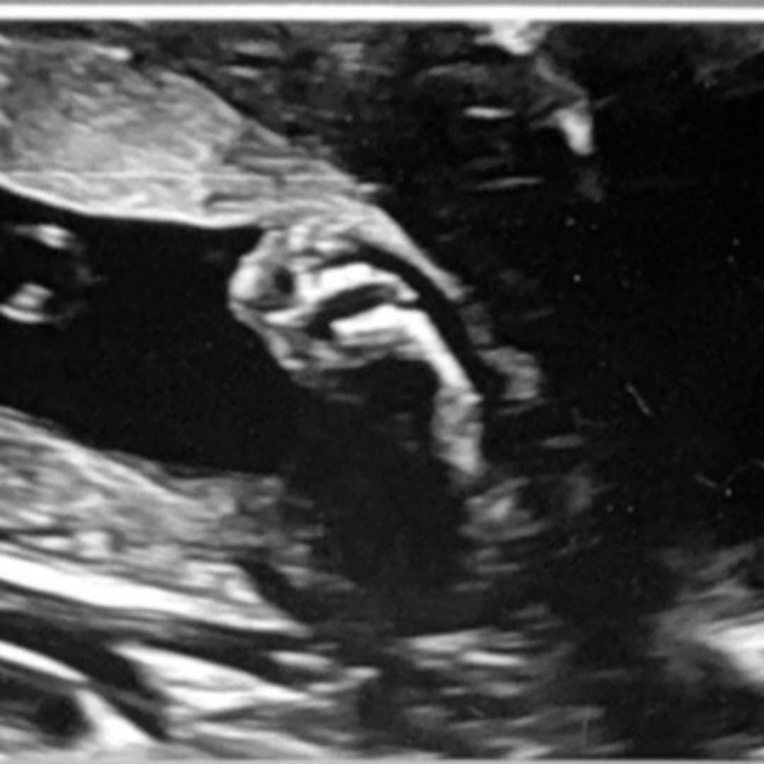 Photo shared by Helen for their Babylist baby registry.